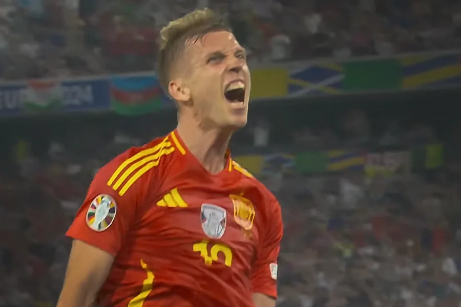 Barcelona Pilih Pendekatan Konservatif untuk Pemulihan Dani Olmo, Demi Cegah Operasi dan Risiko Absensi Panjang Dani Olmo
